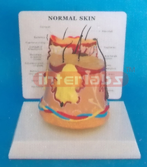 DESK/ROUND TYPE, DISEASE (ACNE) SKIN WITH DESCRIPTION PLATE